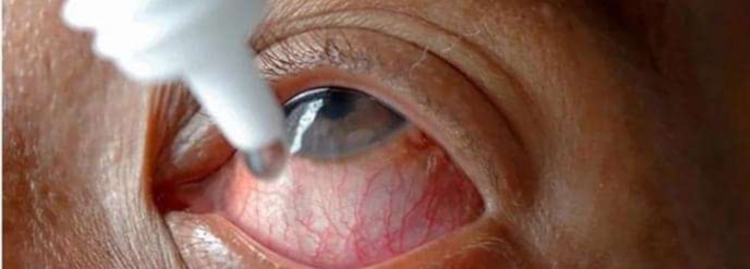 अमेरिकी रोग नियन्त्रण केन्द्रले भन्यो- भारतमा उत्पादित ओभर द काउन्टर आइड्रप प्रयोग नगर्नुस्